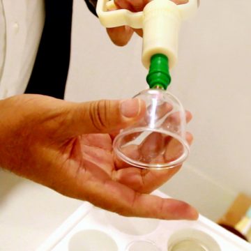 טיפול בכוסות רוח